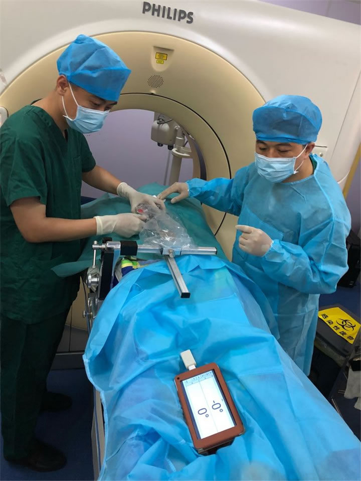 经典病例之穿刺模板引导肺小结节同针道活检消融2